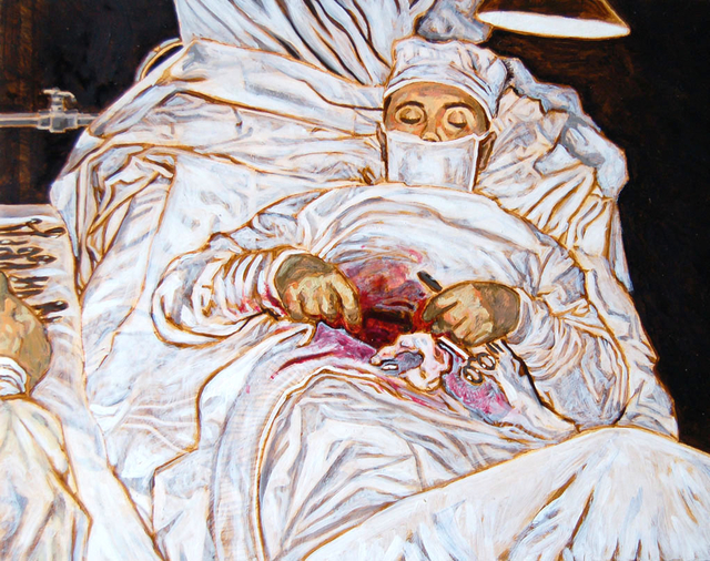 The Cursed Appendage